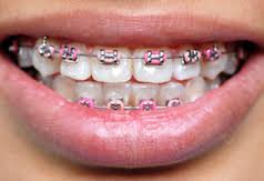 Orthodontist Appointment Reminders